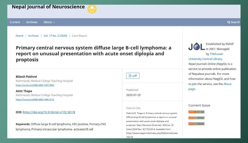 Primary central nervous system diffuse large B-cell lymphoma: a report on unusual presentation with acute onset diplopia and proptosis